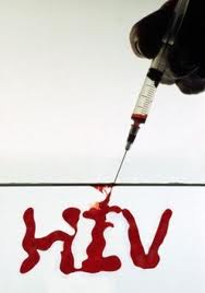 hiv blood, hiv infected blood transfused to the patient
